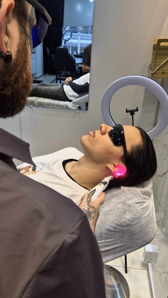 Laserterapia para piercings procedimento anti-inflamatório