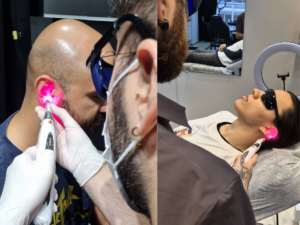 Benefícios da laserterapia para piercing